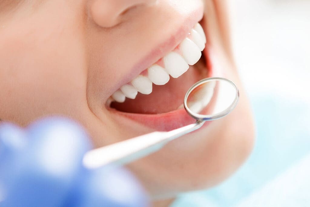 dental bonding, cosmetic dentist CDA