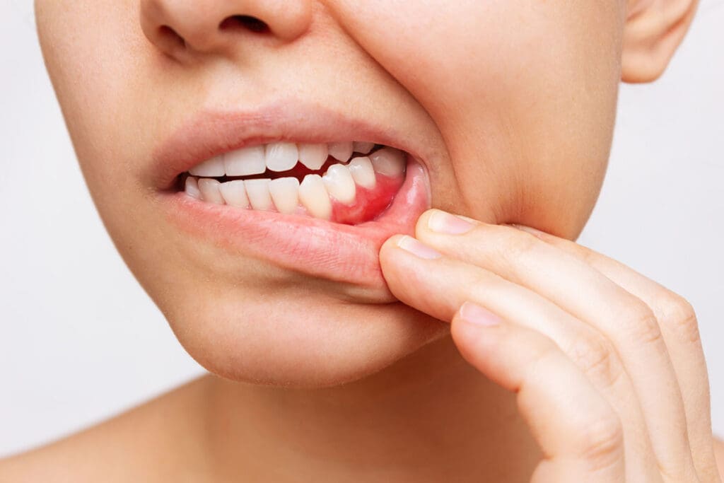 periodontal treatments in Coeur d’Alene